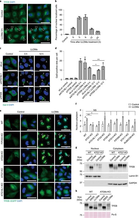 The Lysosomal Damage Induced Nuclear Translocation Of TFEB Is ATG