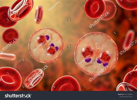 Plasmodium Falciparum Peritoneal Fluid