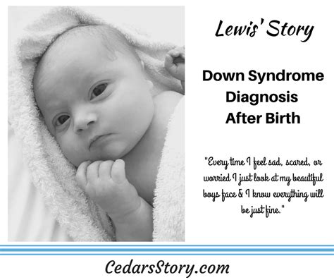 Lewis' Story- Down Syndrome Diagnosis After Birth - Cedars Story