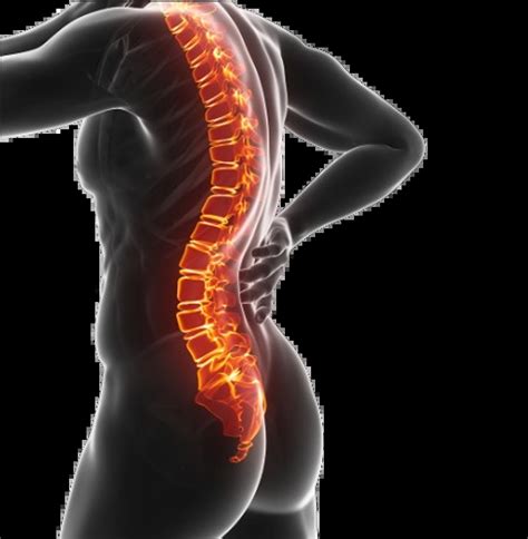 Comprehensive Guide On Lumbar Lordosis Management