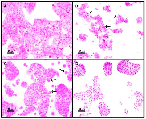 Prevention Of Cytotoxic Effect Caused By Amoebic Trophozoites To Hepg2