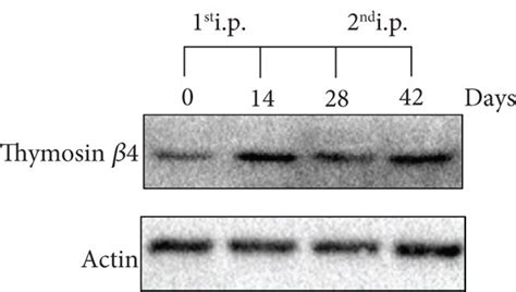 Expression of Tβ4 in mouse heart tissues after intraperitoneal i p