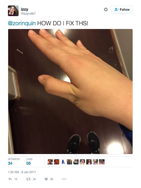 Idiots On Twitter Are Breaking Their Thumbs Over This Stupid Tweet About How To Break Your Thumb