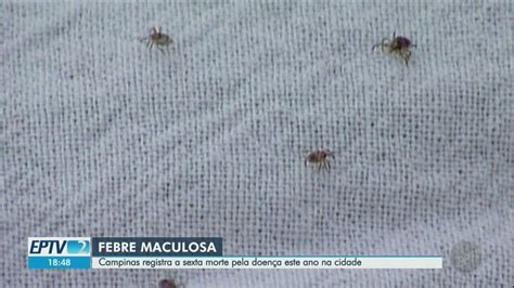 Campinas Confirma Sexta Morte Por Febre Maculosa Em Veja Perfil