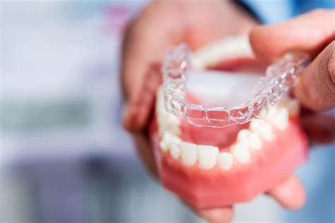 The Invisalign Process From Beginning To End