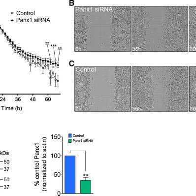 Panx Levels Decrease Across Neuronal Differentiation And Are Important