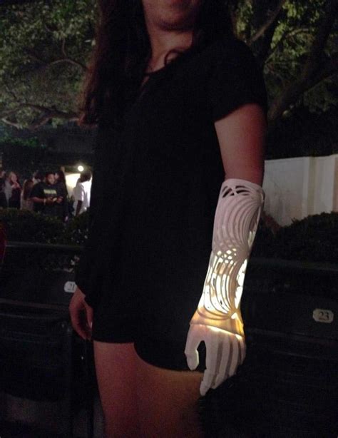 3D Art Meets Prosthetics: Student Creates Beautiful 3D Printed Prosthatic Arm for Friend ...