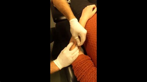 Extensor Carpi Radialis Longus And Brevis Dry Needling Youtube