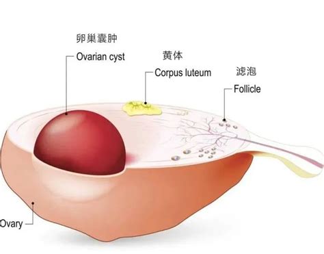 黄体为什么会破裂？如何判断是否为黄体破裂？澎湃号·湃客澎湃新闻 The Paper