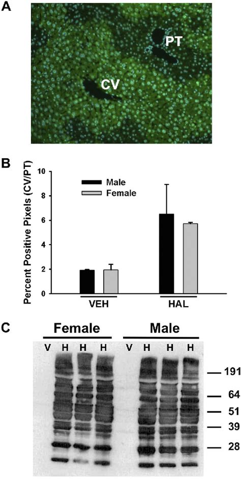 Figure 8 From A Mouse Model Of Severe Halothane Hepatitis Based On