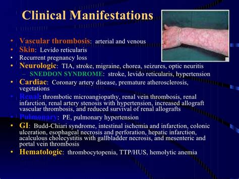 A Case Of Antiphospholipid Antibody Syndrome