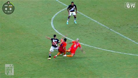 Cenas Fortes Jogador Do Audax Fratura A Perna Em Jogo Contra O Vasco