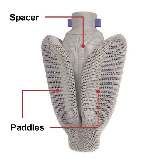 Ce Mark Pascal Clip Based System For Transcatheter Tricuspid Repair