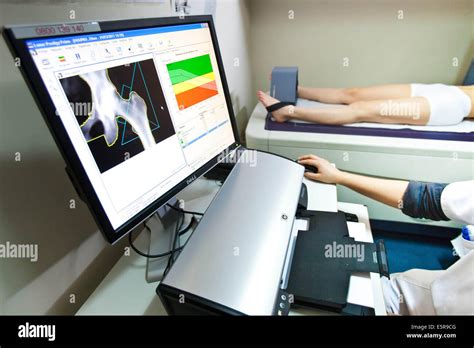 A Doctor Uses A Bone Densitometer To Measure The Optical Density Of The