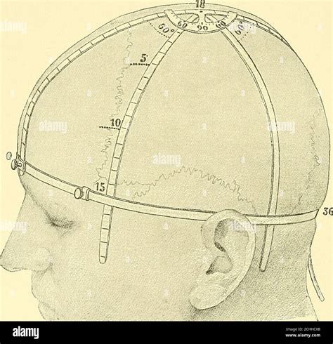 Sagittal Band Hi Res Stock Photography And Images Alamy