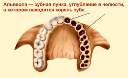 Симптомы сухой лунки после удаления зуба, как лечить альвеолит ...