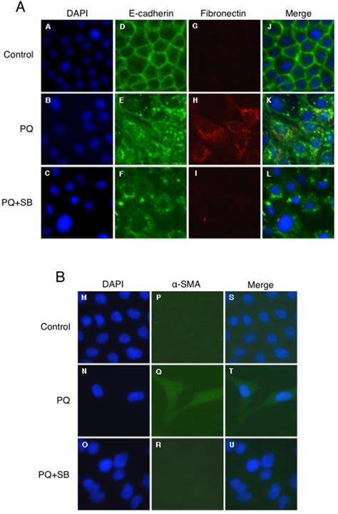 Immunofluorescence analysis of E cadherin fibronectin and α SMA in