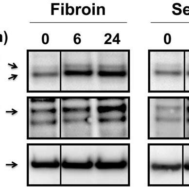 Fibroin And Sericin Induce The Expression Of PAI 1 A Gene Involved In