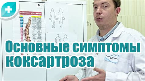 Основные симптомы коксартроза (артроз тазобедренного сустава). - YouTube