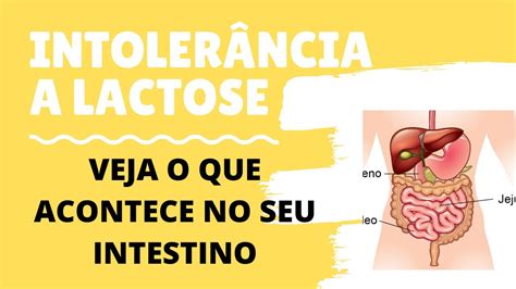 O Que A Intoler Ncia Lactose E O Que Acontece No Seu Corpo Youtube