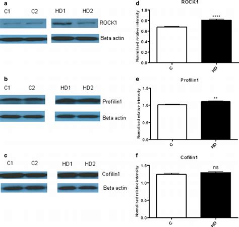 Rock Profilin And Cofilin Protein Levels In Human Postmortem Brain