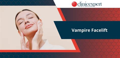 Vampire Facelift | ClinicExpert