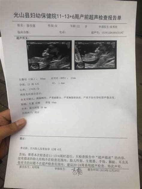 Nt检查报告单12周3天检查的，昨天还没注意看这个单子的图宝宝树