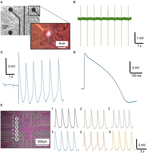 Extracellular And Intracellular Recording From Hipsc Derived Download Scientific Diagram