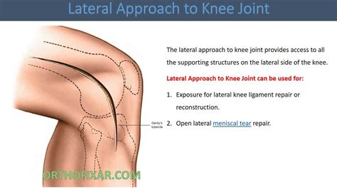 Lateral Knee Joint Usa Store