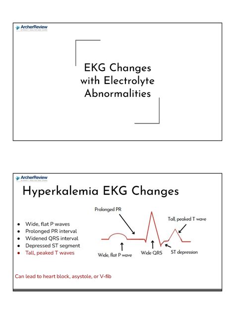 EKG Changes EKG Changes With Electrolyte Abnormalities Hyperkalemia