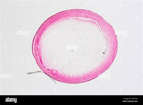 Science Microscopy Micrograph Cleavage Stage Of Frog Egg Stock Photo