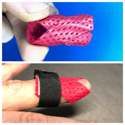 Extension Orthoses And The Stiff Proximal Interphalangeal, 53% OFF