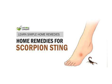 Ppt Best Home Remedies For Scorpion Stings Powerpoint Presentation Free Download Id 7555927