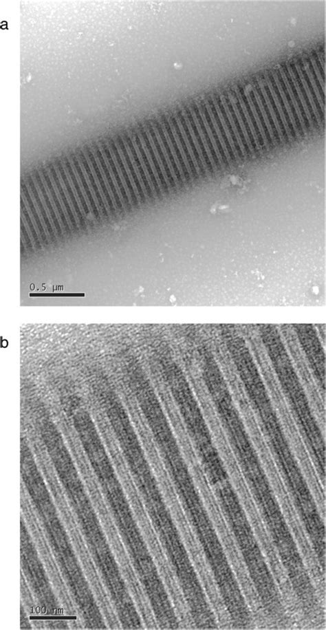 Transmission Electron Microscopy Tem Shows Evidence Of Highly Ordered