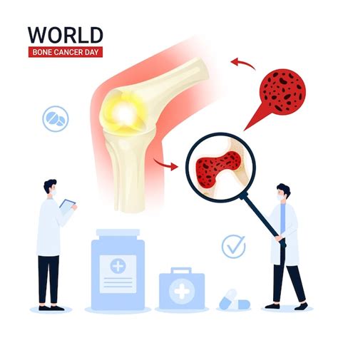 Illustration De La Journ E Mondiale Du Cancer Des Os Vecteur Premium