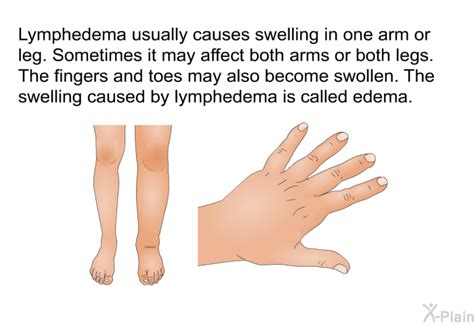 Patedu Lymphedema