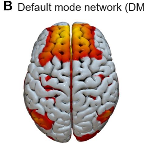 Spatial Lay Out Of The Three Resting State Networks Rsns A Dorsal