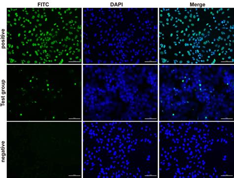 High Affinity And Specificity One Step Tunel In Situ Apoptosis Kit