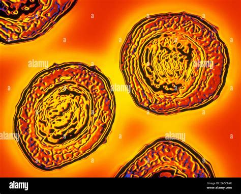 Bordetella Pertussis Equipo Mejorado Micr Grafo Electr Nico De