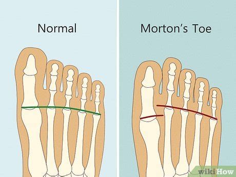 Toe Length Meaning: 10+ Common Superstitions