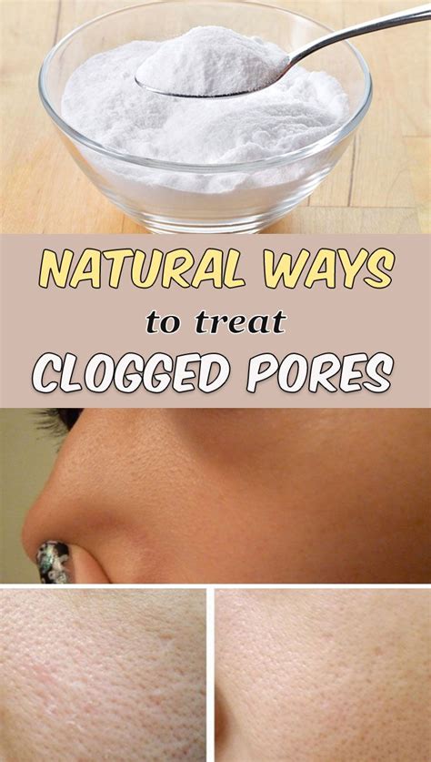 5 Natural Ways To Treat Clogged Pores Treating Clogged Pores Clean