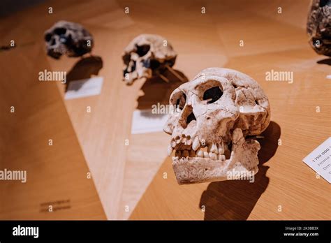 22 July 2022 Dusseldorf Germany Reconstruction Of The Skull From