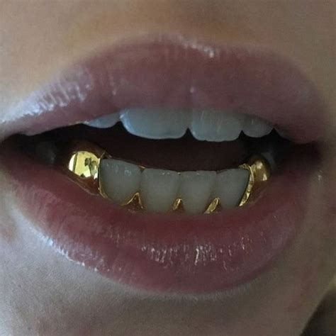 pin: @aaisxru ♡ | Teeth jewelry, Grillz, Grillz teeth