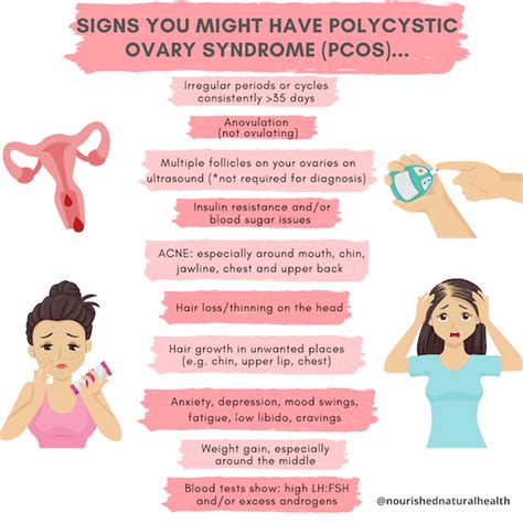 Signs And Symptoms Of Ovulation With Pcos