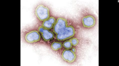 Influenza Virus Under Microscope