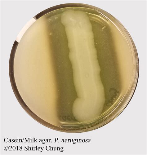 Microbiology Lab 26 Casein Nutrient Agar For Casease Basic Sciences