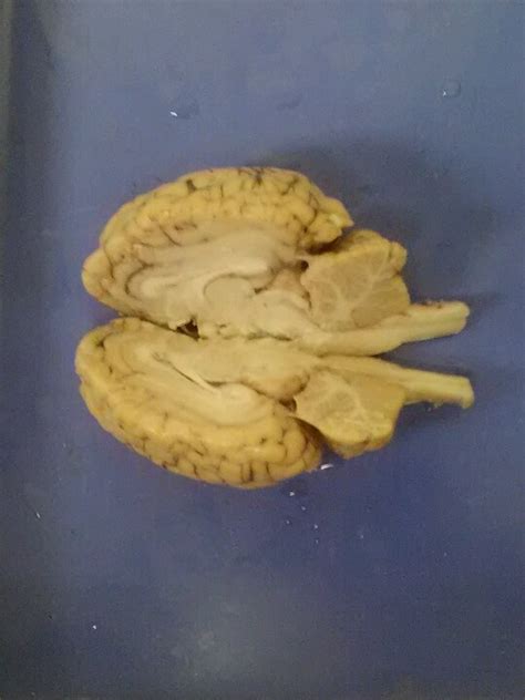 My students did a great job with Central Nervous System anatomy (sheep brain) dissection. Future ...