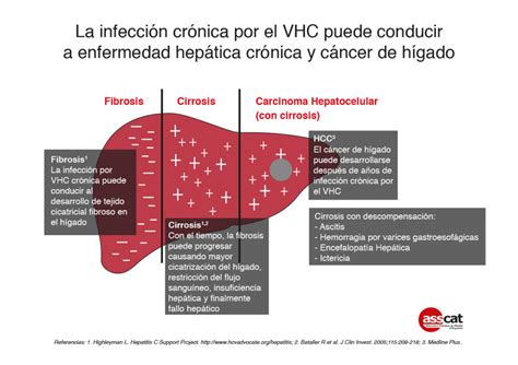 Terapia Médica Del Hepatocarcinoma Hcc Asscat