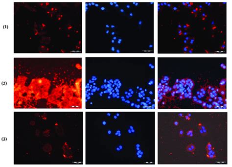 Fluorescent Images Of A Cells Treated With Cy Labeled Nps