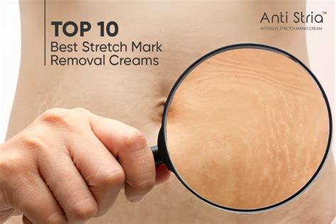 Stretch Mark Removal Creams Unveiling The Top Picks Anti Stria